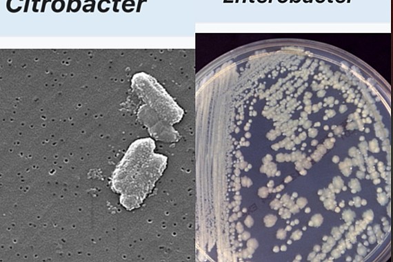 Мантуун буузны маханд хийсэн шинжилгээгээр  ENTEROBACTER, CITROBACTER илэрчээ